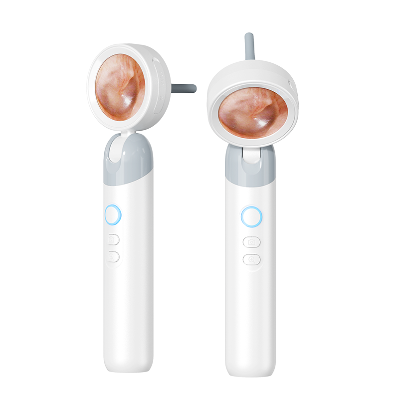 Nareseal HD Video Otoscope with Screen | 2MP Camera, 3.2mm Slim Tip | Rechargeable, Foldable Ear Scope for Doctors, Clinics | Built-in Storage + SD Card Support