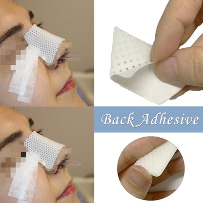 Nareseal Thermoplastic Nasal Splints - External Nasal & Orbital Support Device