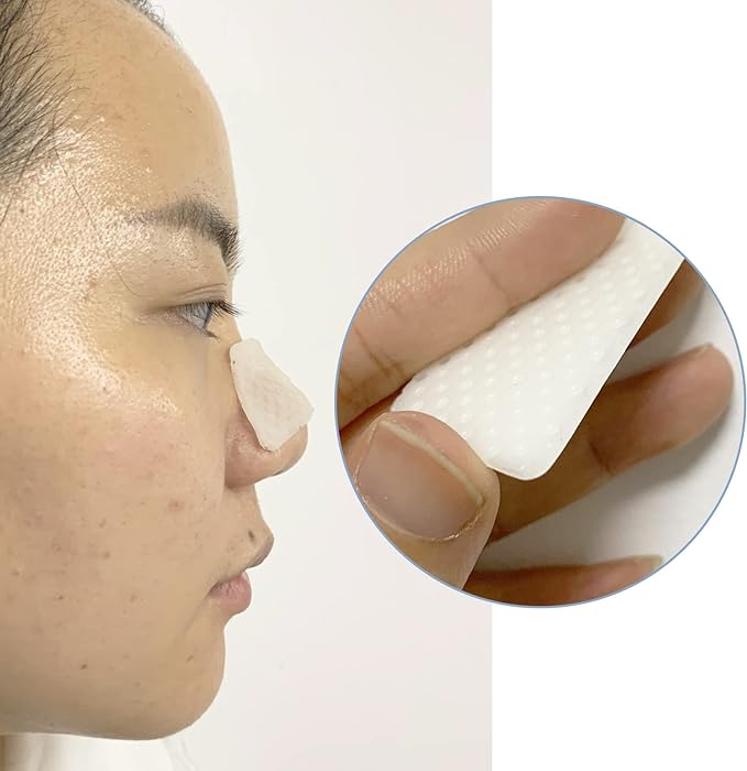 Nareseal Thermoplastic Nasal Splints - External Nasal & Orbital Support Device