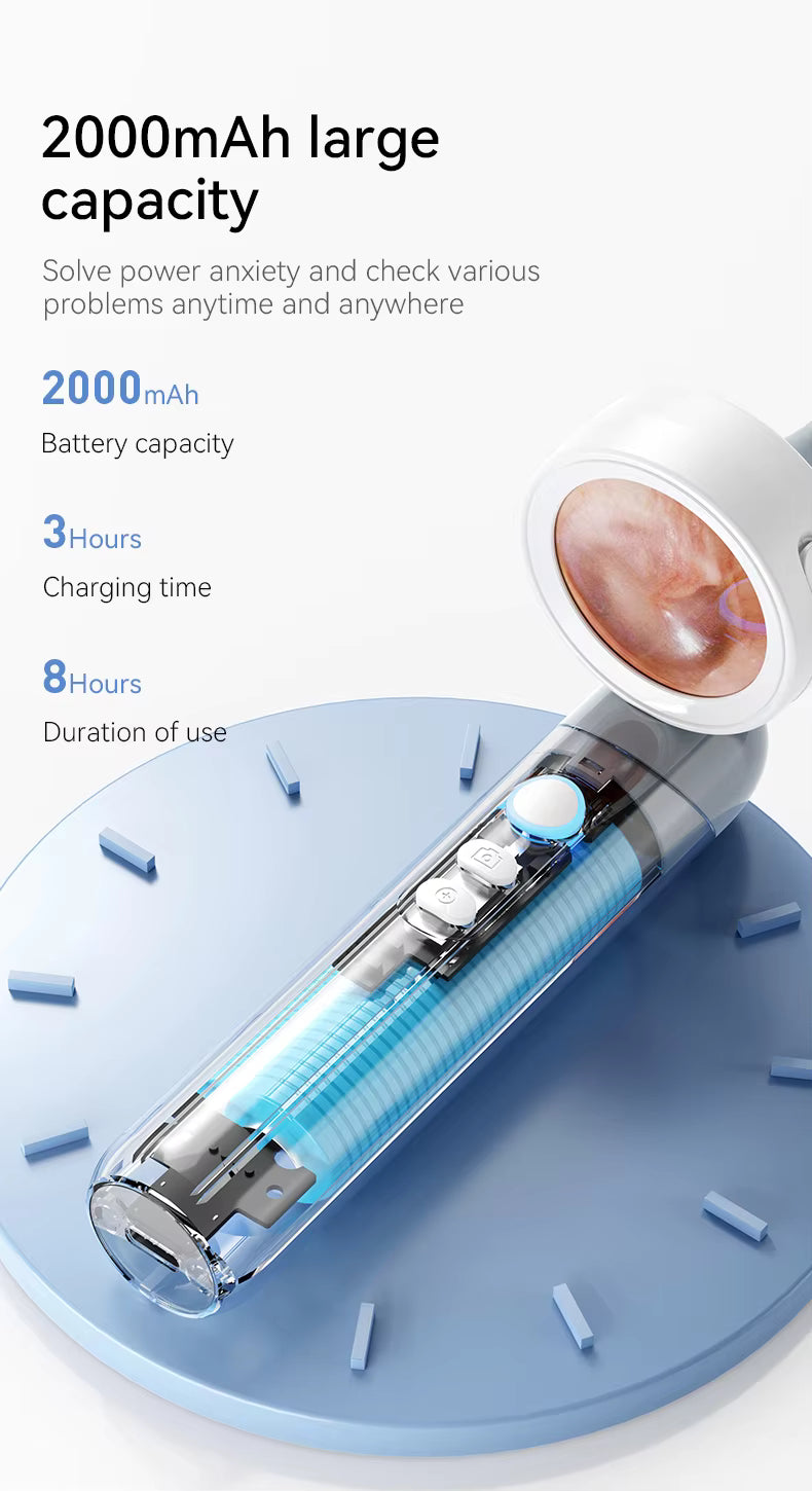 Nareseal HD Video Otoscope with Screen | 2MP Camera, 3.2mm Slim Tip | Rechargeable, Foldable Ear Scope for Doctors, Clinics | Built-in Storage + SD Card Support