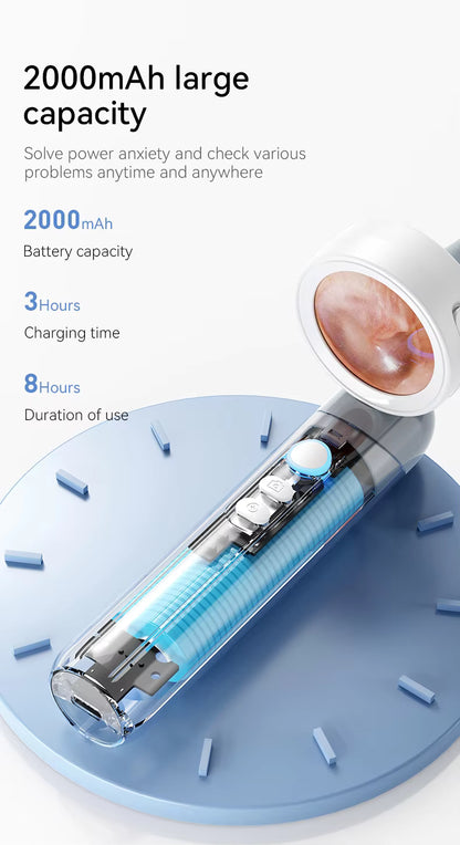 Nareseal HD Video Otoscope with Screen | 2MP Camera, 3.2mm Slim Tip | Rechargeable, Foldable Ear Scope for Doctors, Clinics | Built-in Storage + SD Card Support