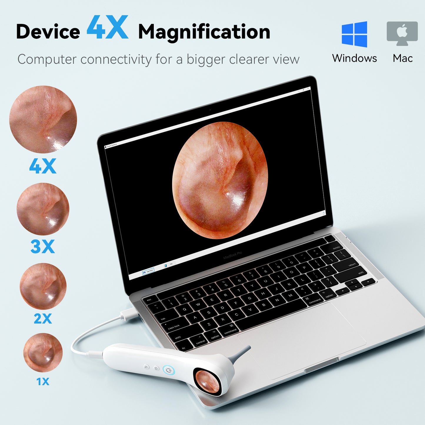 Netcare HD Video Otoscope with Screen | 3.2mm Slim Tip | Rechargeable, Otoscope for Doctors, Clinics | Built-in Storage + SD Card Support Q12