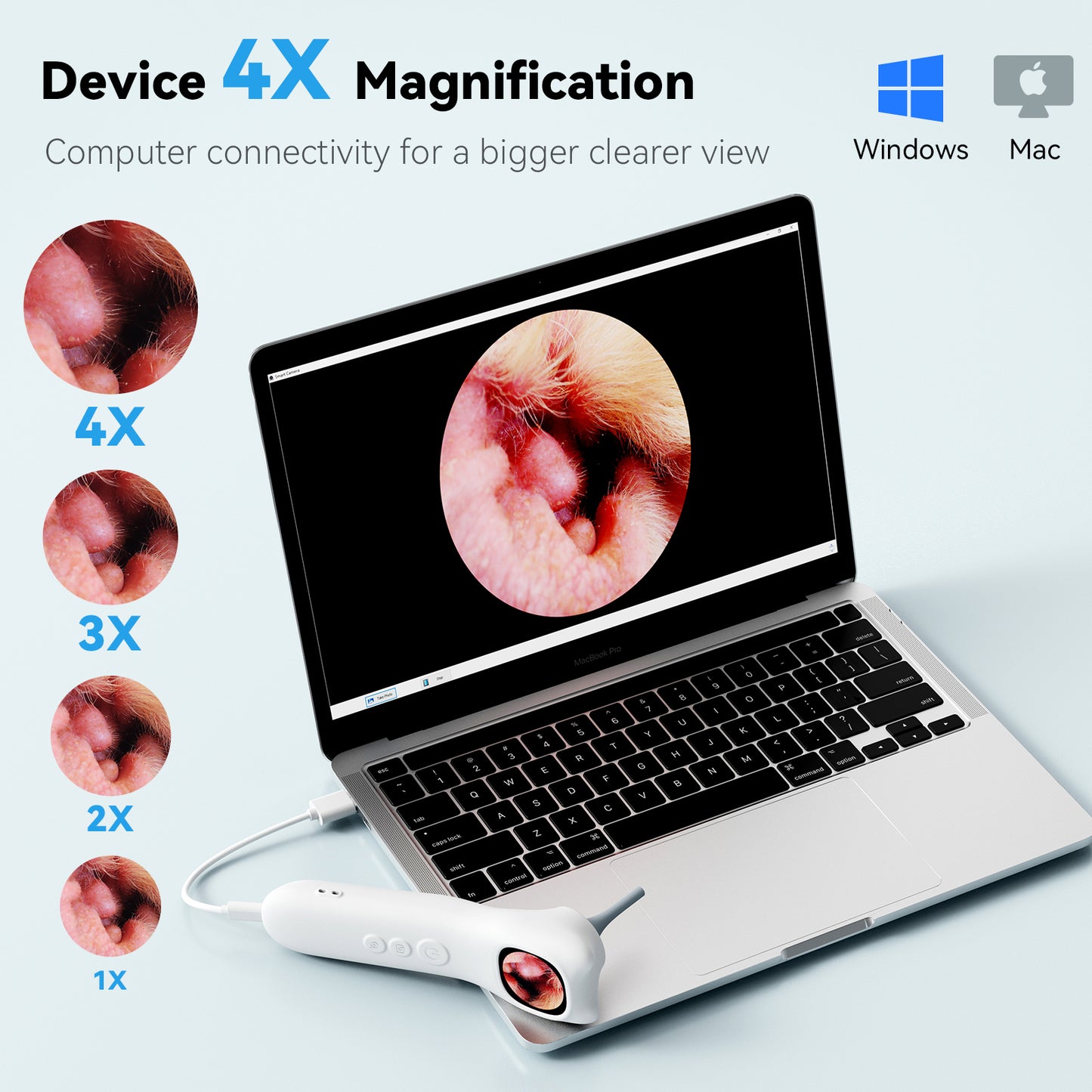Veterinary Digital Otoscope 1080P HD for Dogs, Cats & Exotics | Rechargeable, Otoscope for Doctors, Clinics